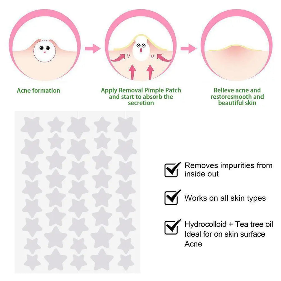 40Pcs Pimple Patches Colorful Star-Shaped PE Pimple Patches for Ance Cute and Invisible Pimple Cover Stickers for Pimple Removal