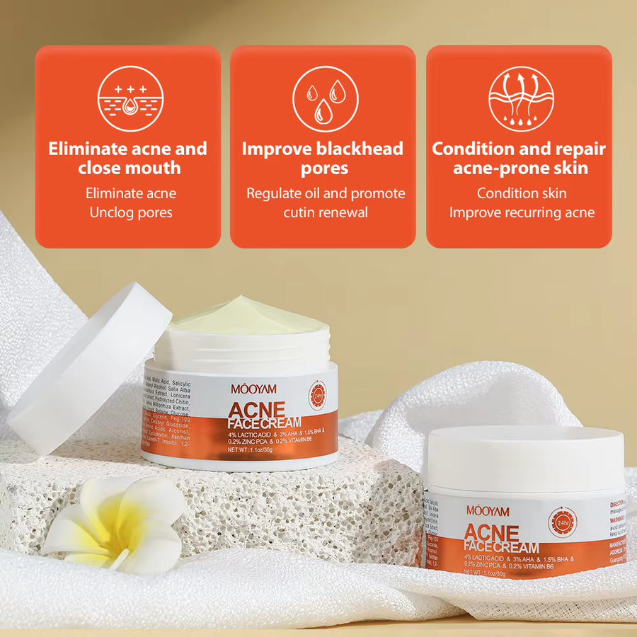 Herbal Acne Removal Face Cream Improve Acne Gel Lighten Acne Scar Pore Shrinking Eliminate Large Pores Pimples Brighten Face Car